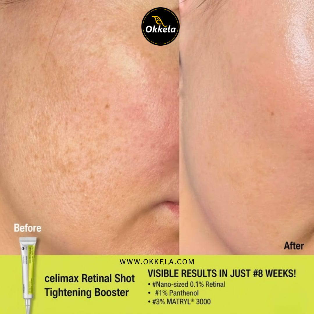 Celimax Retinal Shot Tightening Booster